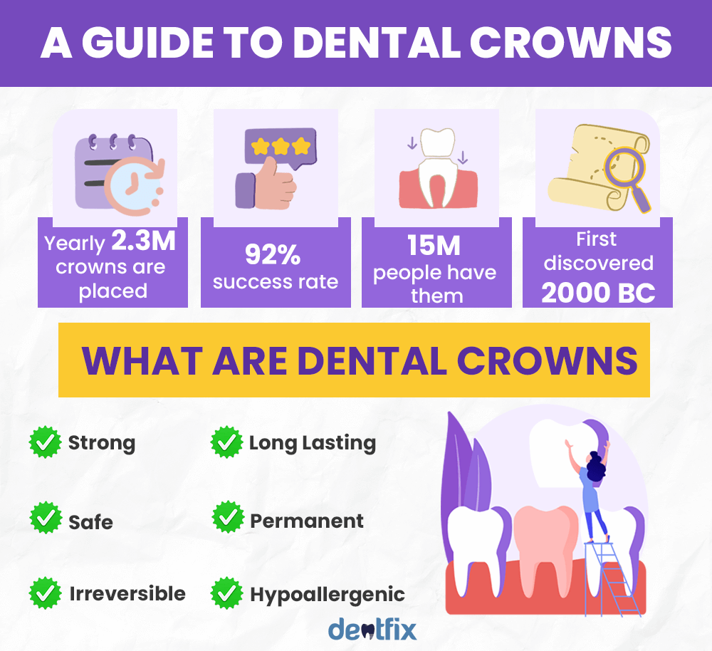 Dental Crowns: a complete easy guide with everything you need to know!