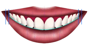 What is a perfect smile? The society’s POV